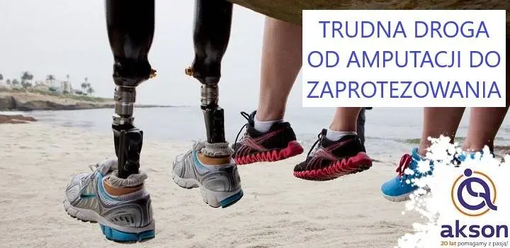 Amputacja kończyny dolnej