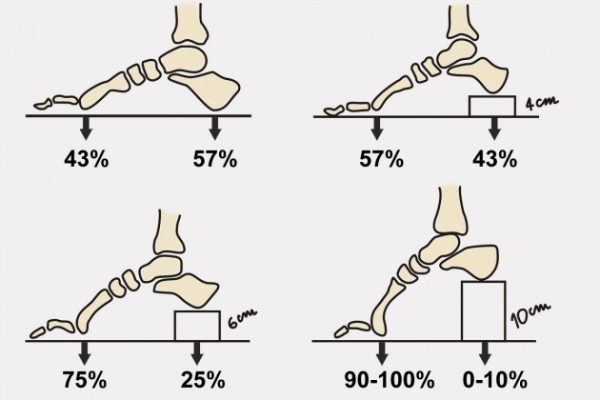Bunion brace AM-OP-01 - Image 2
