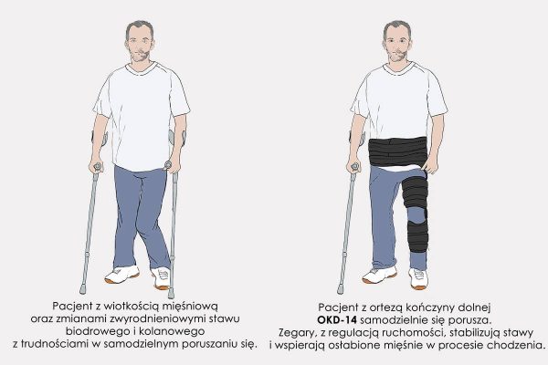 Hip and knee orthosis OKD-14 - Image 3