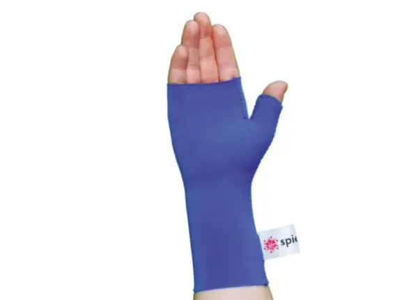 WHO compression hand orthosis Hylton Orthotics by SPIO - Image 1