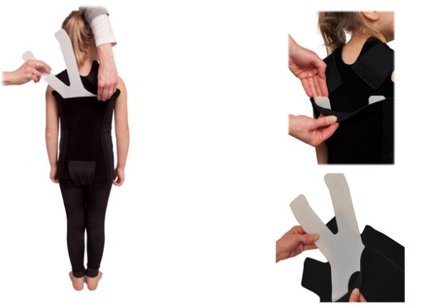 TLSO Expedition compression vest with X-Panel Hylton Orthotics by SPIO - Image 2